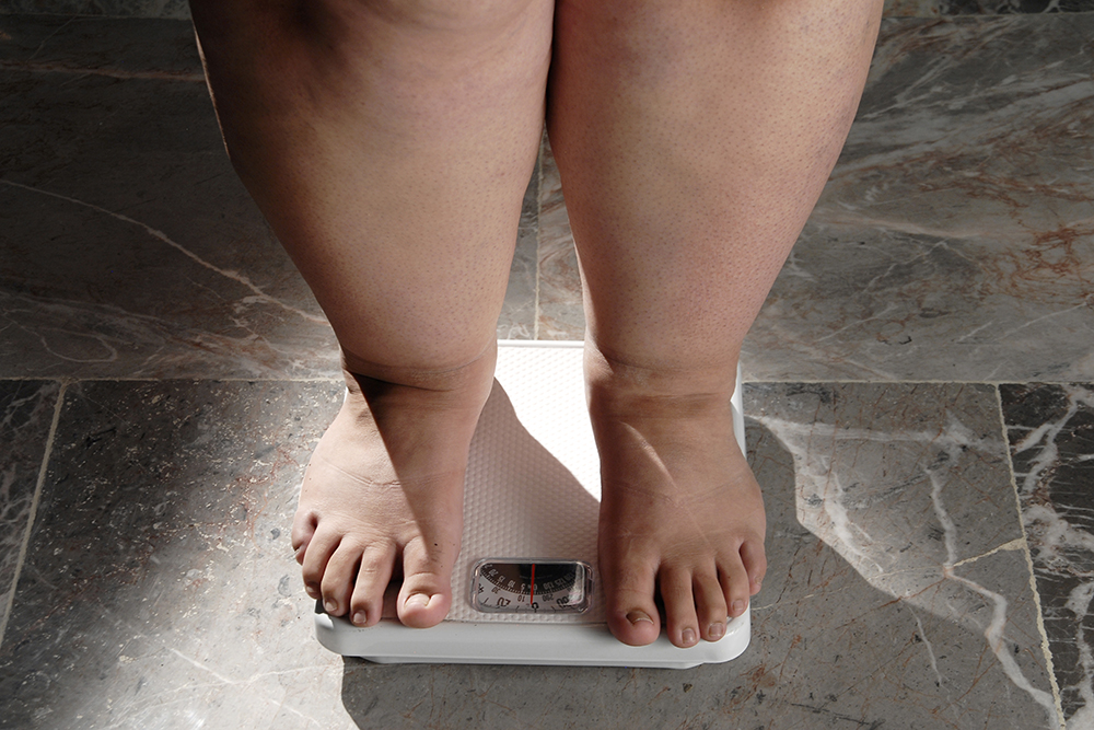 7 Fatos Sobre A Obesidade Que Você Precisa Saber Belive 1319